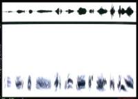Waveform and spectrogram of a bird song