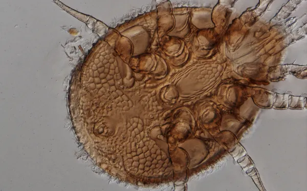 Picture of microscopic bug